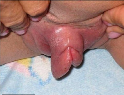 Miniature